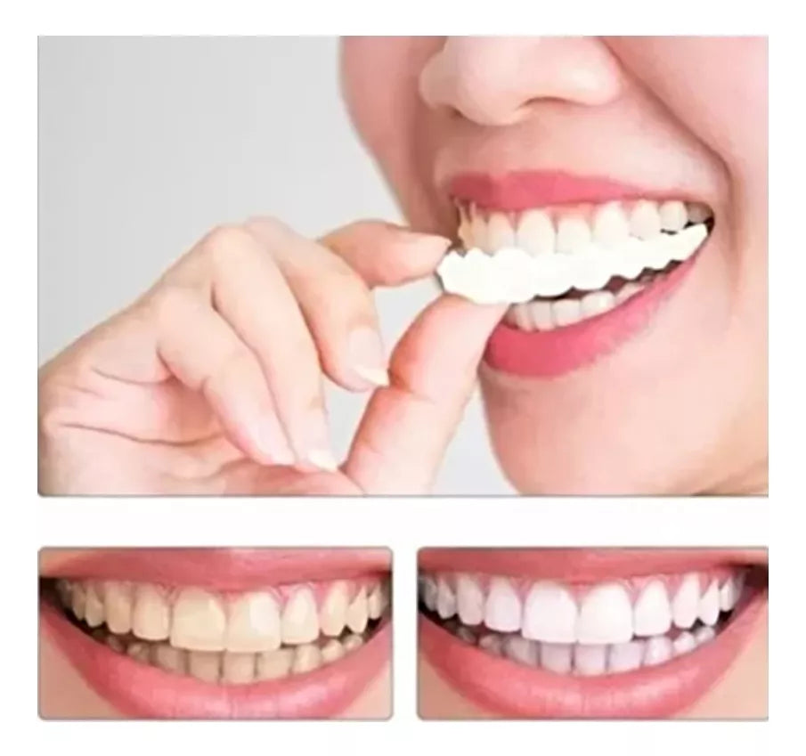 DENTPRO - CARILLAS DENTALES